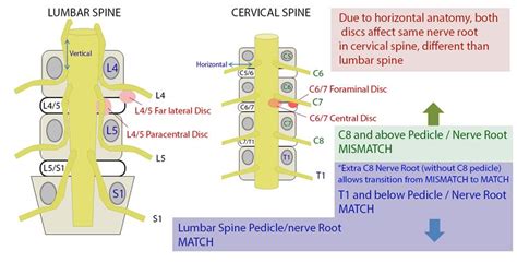 Cervical Radiculopathy Spine Orthobullets