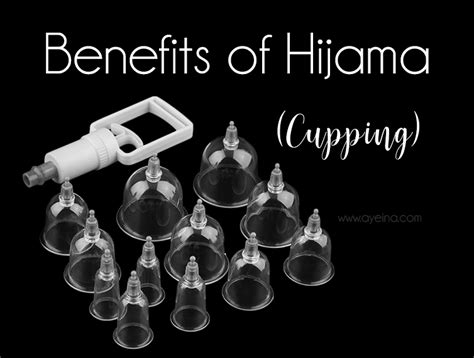 5 reasons why you should get hijama [cupping] done ayeina