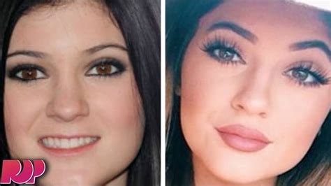 kylie jenner admits to getting lip implants tyt network