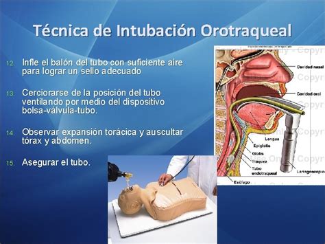 Intubacin Endotraqueal Intubacin Endotraqueal Consiste En La Colocacin