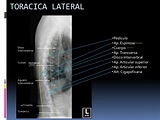 Manual rx columna vertebral | Columnas, Radiología, Farmacologia enfermeria