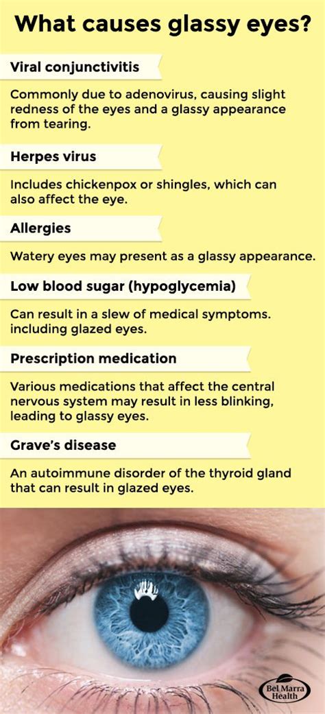 10 Causes Of Glassy Eyes Treatment And Prevention Alternative Health