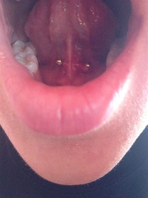Chrome lotus (orlando, fl 32817). Picture of my crooked and flared up tongue web piercing ...