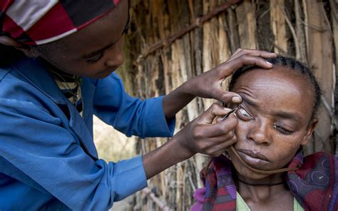 Shashetus Story Ethiopia Fred Hollows Foundation Fred Hollows