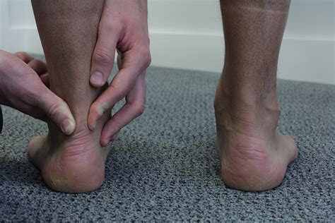 Achilles Tendonitis Above Ankle Biomechanical Problems What We