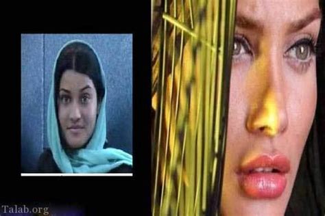 عکس های لو رفته بازیگران زن ایرانی قبل از عمل زیبایی