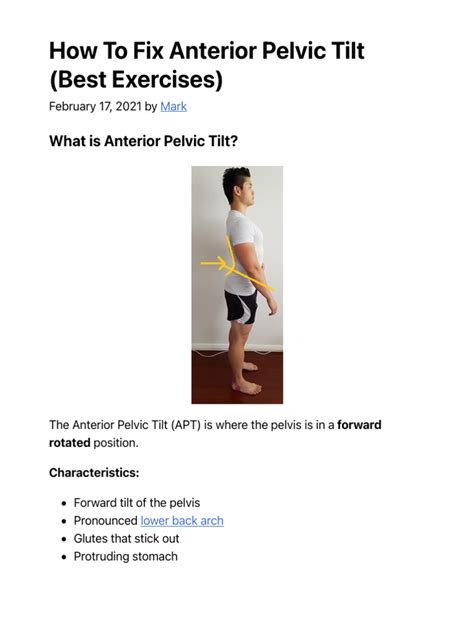 How To Fix Anterior Pelvic Tilt Best Exercises Posture Direct Pdf