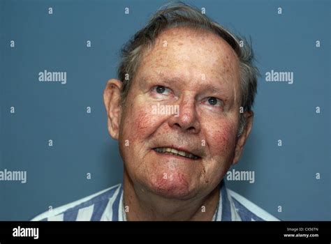 Elderly Mans Face Showing Age Spots Blood Vessels And Skin Sploctches