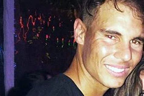 Rafa Nadal Has Hair Transplant In Bid To Protect His