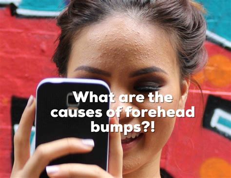 Overview Of A Bumpy Forehead — Liz Claire Little Bumps On Forehead