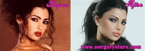 Haifa Wehbe Before Plastic Surgery