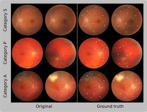 Registrable Fundus Image Pairs From The Three Different Categories Of