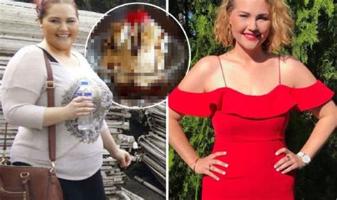 Weight Loss Woman Cut Sugar From Her Diet And Lost Over Seven Stone Uk