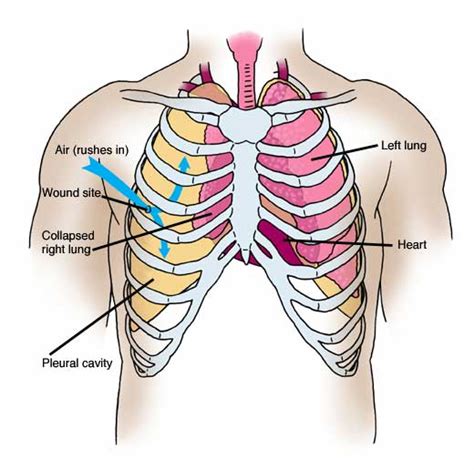 Anatomy Of Chest Area Intercostal Muscles Function Area And Course
