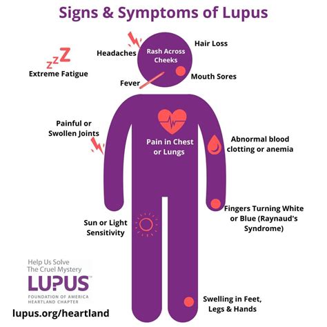 ¿qué Tan Común Es El Lupus Y A Quién Afecta Postlatino