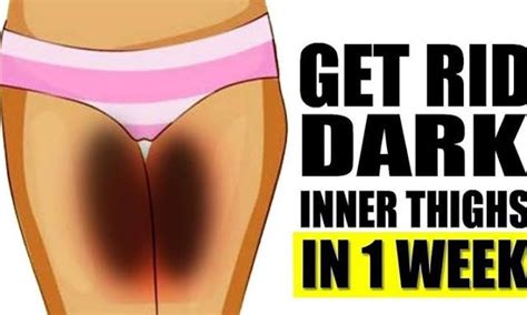remedies for dark inner thighs to get lighter skin naturally v beautify