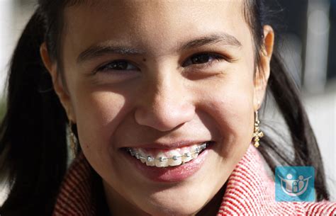 Tips From An Orthodontist For Getting Used To Braces