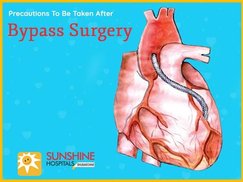 Precautions To Be Taken After Bypass Surgery Free Download Borrow