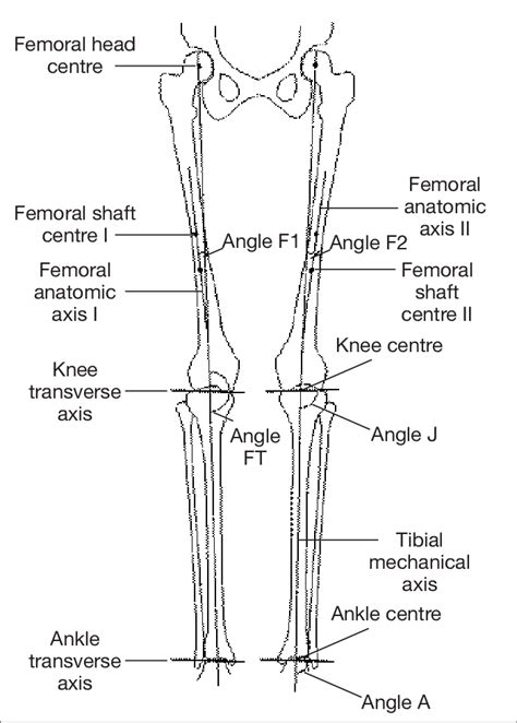 Axes And Angles Of The Lower Limb Download Scientific Diagram