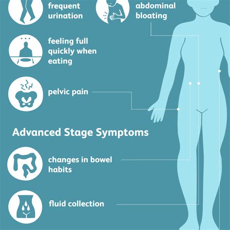Ovarian Cancer Symptoms Four Of The Most Common Signs Of Ovarian Hot