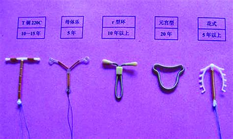 Iud was invented a long time ago and became one of the most effective birth control methods. Forced contraception - Global Times