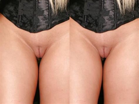 Stereoscopic Shaved Pussy Closeup Standing Nomapoutnik