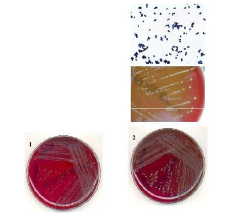 Very few documented cases of severe infections caused by dermabacter hominis have been published. Aerococcus urinae - Infectious Disease and Antimicrobial ...
