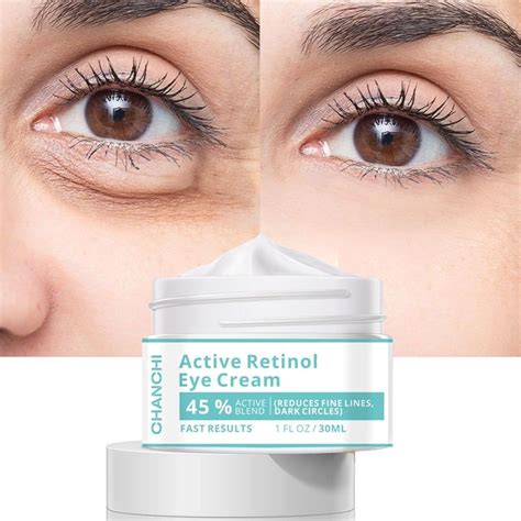 Instant Eye Bags Removal Cream In 2022 Eye Bag Cream Anti Wrinkle