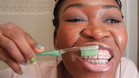 It's a process to brush your teeth with braces. {#25}: (step by step guide): BRUSHING TEETH WITH BRACES ON ...