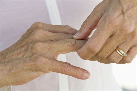 How To Get Rid Of Arthritis In The Fingers