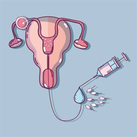 Best Artificial Insemination Illustrations Royalty Free Vector