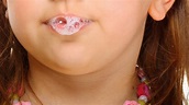 ¿Cuál es la función de la saliva en nuestra salud oral? | Dental Davila