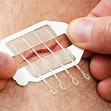 Needle-Free Tightening Suture Wound Band-Aid - Online Molooco Shop