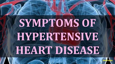 Symptoms Of Hypertensive Heart Disease Youtube