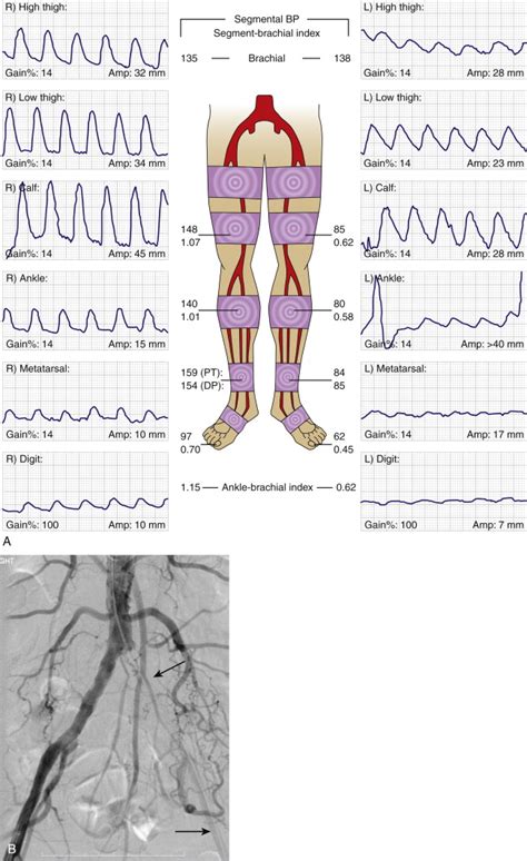 Lower Extremity Arteries Radiology Key