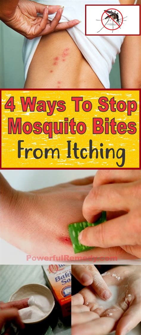 4 Ways To Stop Mosquito Bites From Itching Insect Bite Remedy