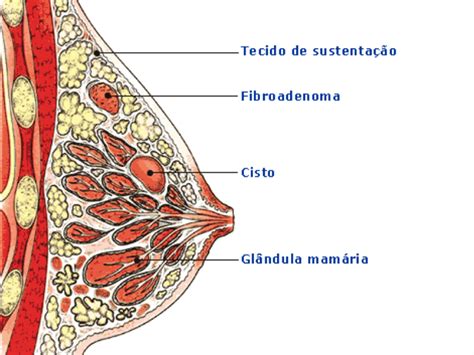 Qual é a Diferença Entre Nódulo e Cisto vivendobauru com br