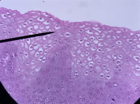 Vagina Histology