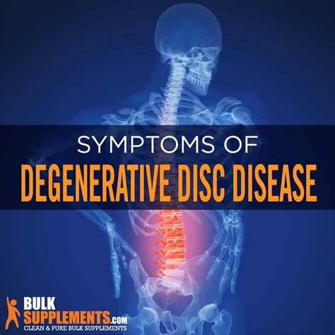Degenerative Disc Disease Symptoms Causes And Treatment