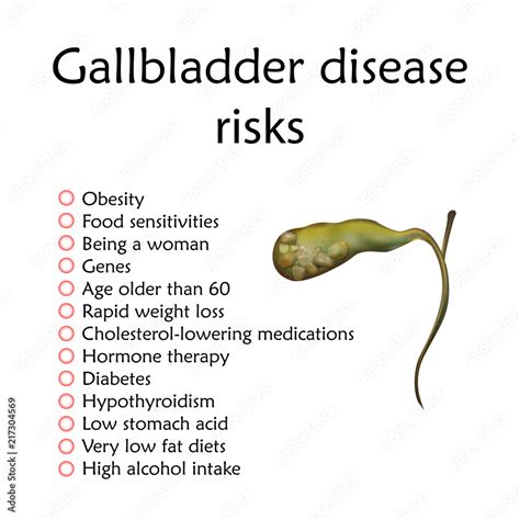 Gallbladder Disease Risks Inflammation Gallstones Cholecystitis