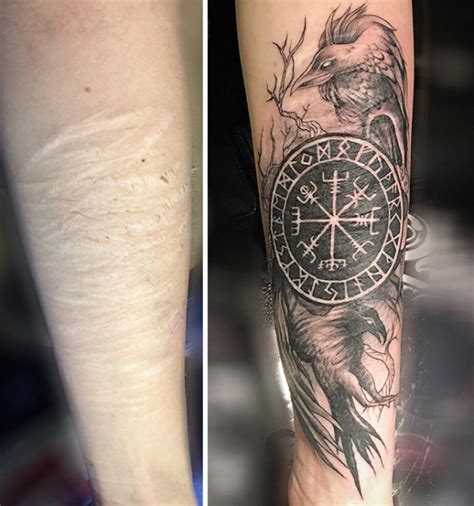 15 Awesome Tattoos That Turn Scars Into Clever Works Of Art