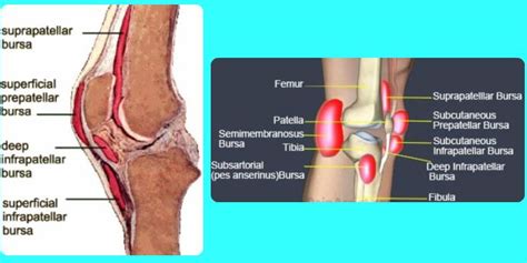 Bursitis Knee Treatment Pictures Symptoms Causes Diagnosis
