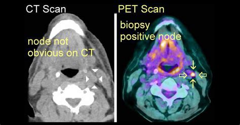 Pet scans may last up to 35 minutes for the test itself, plus the time it takes to prepare. Pet-CT Scan