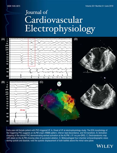 Sex Hormones And Jumping Heart Beats Heyden 2019 Journal Of Cardiovascular