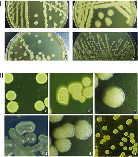 Microscopic Comparison Of Morphologically Different Bacterial Colonies