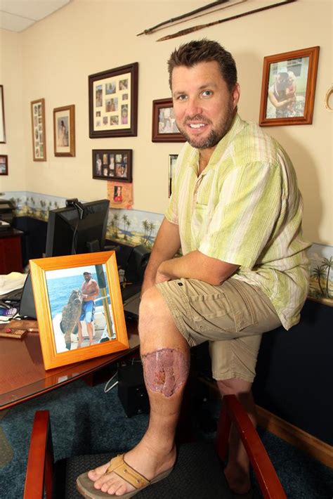 Shark Bite Victim Erik Norrie Helps Shine Spotlight On Smith And Nephew