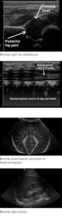 Pediatric Peninsula Diagnostic Imaging Mammography Ultrasound