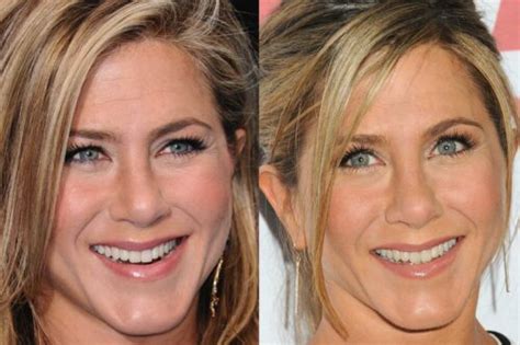 Jennifer Aniston Botox Make Her Talk Funny Kirkpatrick Primses