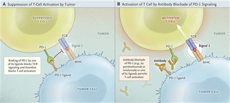 Releasing The Brakes On Cancer Immunotherapy Nejm