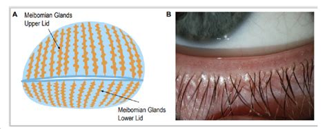 Meibomian Gland Structure